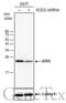 Superoxide Dismutase 2 antibody, GTX630558, GeneTex, Western Blot image 