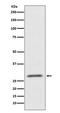 CD99 Molecule (Xg Blood Group) antibody, M01724-1, Boster Biological Technology, Western Blot image 