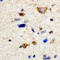 Protein Kinase, Membrane Associated Tyrosine/Threonine 1 antibody, LS-C368467, Lifespan Biosciences, Immunohistochemistry frozen image 