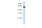 Tripartite Motif Containing 60 antibody, A17298, Boster Biological Technology, Western Blot image 