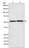 Solute Carrier Family 2 Member 3 antibody, M03259, Boster Biological Technology, Western Blot image 