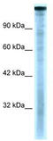 TATA-Box Binding Protein Associated Factor 1 antibody, TA330561, Origene, Western Blot image 
