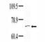 Non-receptor tyrosine-protein kinase TNK1 antibody, F40160-0.4ML, NSJ Bioreagents, Western Blot image 