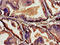 Thymic Stromal Lymphopoietin antibody, LS-C394872, Lifespan Biosciences, Immunohistochemistry paraffin image 