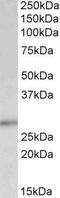 Cyclin Dependent Kinase Inhibitor 1B antibody, GTX89293, GeneTex, Western Blot image 