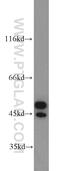 Annexin A7 antibody, 10154-2-AP, Proteintech Group, Western Blot image 