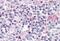 TOR antibody, MBS243268, MyBioSource, Immunohistochemistry paraffin image 