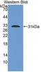 Toll Like Receptor 1 antibody, LS-C701764, Lifespan Biosciences, Western Blot image 