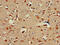 ALX Homeobox 1 antibody, CSB-PA624031LA01HU, Cusabio, Immunohistochemistry paraffin image 