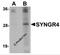 Synaptogyrin 4 antibody, 5569, ProSci Inc, Western Blot image 
