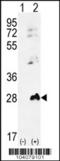 Adenylate Kinase 1 antibody, 63-437, ProSci, Western Blot image 