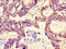 Ret Finger Protein Like 4B antibody, A63318-100, Epigentek, Immunohistochemistry paraffin image 