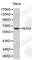 NADPH Oxidase 4 antibody, A1528, ABclonal Technology, Western Blot image 