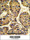 Asporin antibody, 62-356, ProSci, Immunohistochemistry paraffin image 
