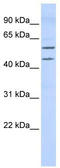 T-Box 22 antibody, TA331138, Origene, Western Blot image 
