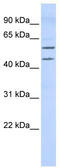 T-Box 22 antibody, TA331138, Origene, Western Blot image 