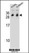 Cytochrome B561 Family Member D1 antibody, 55-585, ProSci, Western Blot image 