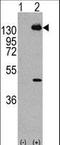Platelet Derived Growth Factor Receptor Alpha antibody, LS-B9120, Lifespan Biosciences, Western Blot image 