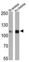 ATPase Sarcoplasmic/Endoplasmic Reticulum Ca2+ Transporting 2 antibody, NB300-529, Novus Biologicals, Western Blot image 