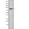 Actin Binding LIM Protein 1 antibody, abx147899, Abbexa, Western Blot image 