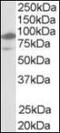 Nuclear Receptor Subfamily 1 Group H Member 2 antibody, orb88625, Biorbyt, Western Blot image 