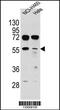 TSPY Like 6 antibody, 55-764, ProSci, Western Blot image 