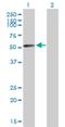 N-acetylgalactosamine-6-sulfatase antibody, H00002588-B01P, Novus Biologicals, Western Blot image 