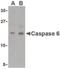 Caspase 6 antibody, PA5-20116, Invitrogen Antibodies, Western Blot image 