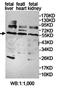 Pleckstrin Homology Domain Containing A8 antibody, orb78247, Biorbyt, Western Blot image 