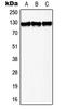 Telomerase Reverse Transcriptase antibody, LS-C353802, Lifespan Biosciences, Western Blot image 