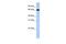 Solute Carrier Family 22 Member 13 antibody, PA5-42438, Invitrogen Antibodies, Western Blot image 