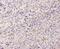 EMAP Like 4 antibody, A00930-1, Boster Biological Technology, Immunohistochemistry paraffin image 