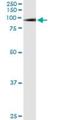 SMAD Specific E3 Ubiquitin Protein Ligase 1 antibody, H00057154-M01, Novus Biologicals, Immunoprecipitation image 