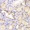 Proteasome 26S Subunit, ATPase 6 antibody, GTX33436, GeneTex, Immunohistochemistry paraffin image 