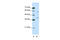 Heterogeneous Nuclear Ribonucleoprotein A3 antibody, 29-528, ProSci, Immunohistochemistry paraffin image 