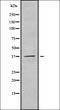 Arylsulfatase B antibody, orb338023, Biorbyt, Western Blot image 