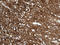 Drebrin 1 antibody, LS-C796263, Lifespan Biosciences, Immunohistochemistry paraffin image 
