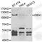 Drebrin 1 antibody, A6366, ABclonal Technology, Western Blot image 