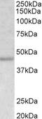 Actin Alpha 2, Smooth Muscle antibody, EB06450, Everest Biotech, Western Blot image 