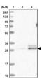Tetratricopeptide Repeat Domain 33 antibody, NBP1-82468, Novus Biologicals, Western Blot image 