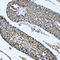 Nucleolar Protein 3 antibody, LS-C335655, Lifespan Biosciences, Immunohistochemistry paraffin image 