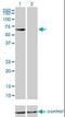 Cystathionine-Beta-Synthase antibody, orb95021, Biorbyt, Western Blot image 