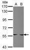 Amidophosphoribosyltransferase antibody, GTX102725, GeneTex, Western Blot image 