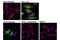 Heat Shock Protein Family B (Small) Member 1 antibody, 12172S, Cell Signaling Technology, Immunofluorescence image 