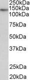 Testis-specific Y-encoded-like protein 2 antibody, 42-955, ProSci, Enzyme Linked Immunosorbent Assay image 