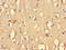 Protein Arginine Methyltransferase 5 antibody, LS-C679182, Lifespan Biosciences, Immunohistochemistry paraffin image 