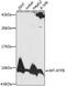 Mitochondrially Encoded ATP Synthase Membrane Subunit 8 antibody, 18-154, ProSci, Western Blot image 