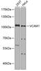 Vascular Cell Adhesion Molecule 1 antibody, 13-124, ProSci, Western Blot image 