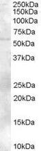 Zinc Finger And BTB Domain Containing 32 antibody, GTX89643, GeneTex, Western Blot image 