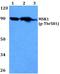 Ribosomal Protein S6 Kinase A5 antibody, A04922T581, Boster Biological Technology, Western Blot image 